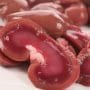Kidney ( whole )
